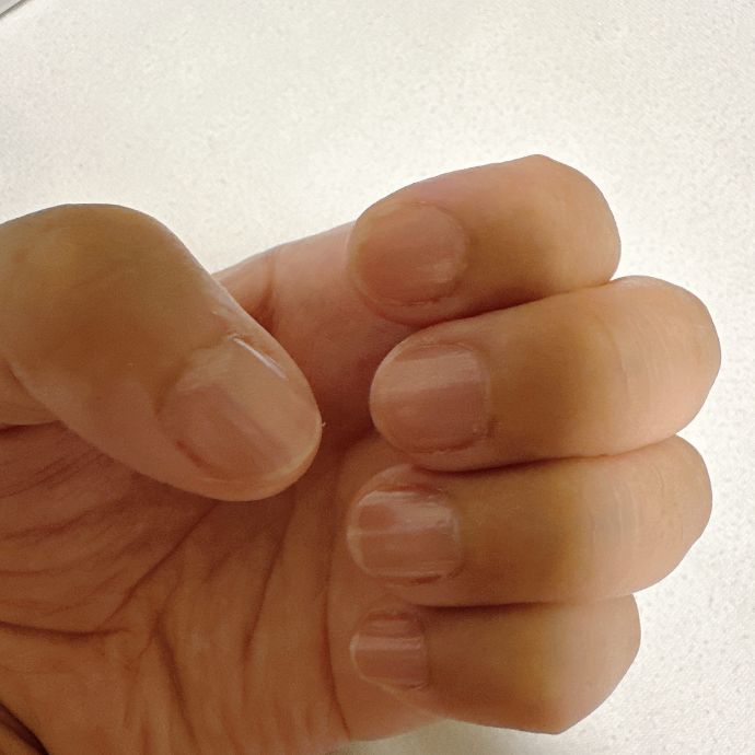 Nail